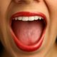 Причины появления и лечение белых язв во рту